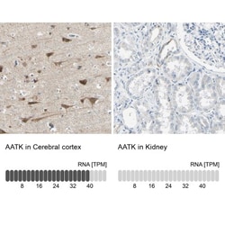 AATK/Serine/threonine-protein kinase LMTK1 Antibody, Novus Biologicals:Antibodies:Primary